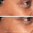 3x retinol eye lift serum_imgCarousel_before and after.webp