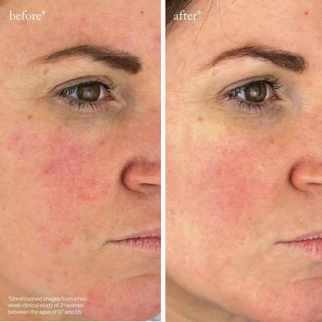 youth boost peptide serum_imgCarousel_before and after.webp