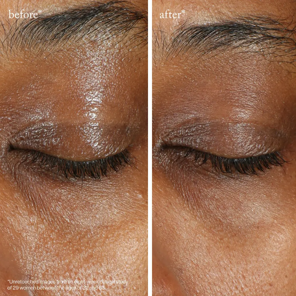 vitac eye cream_imgCarousel_before and after.webp