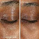 vitac eye cream_imgCarousel_before and after.webp