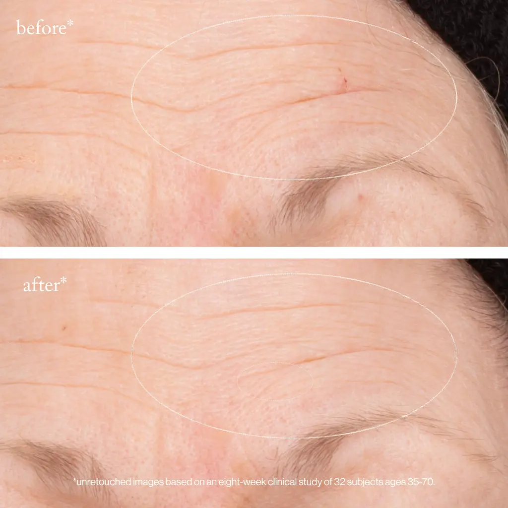 3x retinol regenerative serum_imgCarousel_before and after.webp