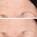 3x retinol regenerative serum_imgCarousel_before and after.webp