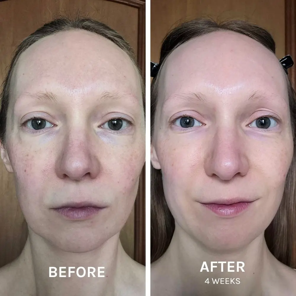CHRISTINA - EGF BEFORE & AFTER SQUARE.webp