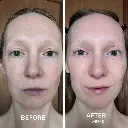 CHRISTINA - EGF BEFORE & AFTER SQUARE.webp